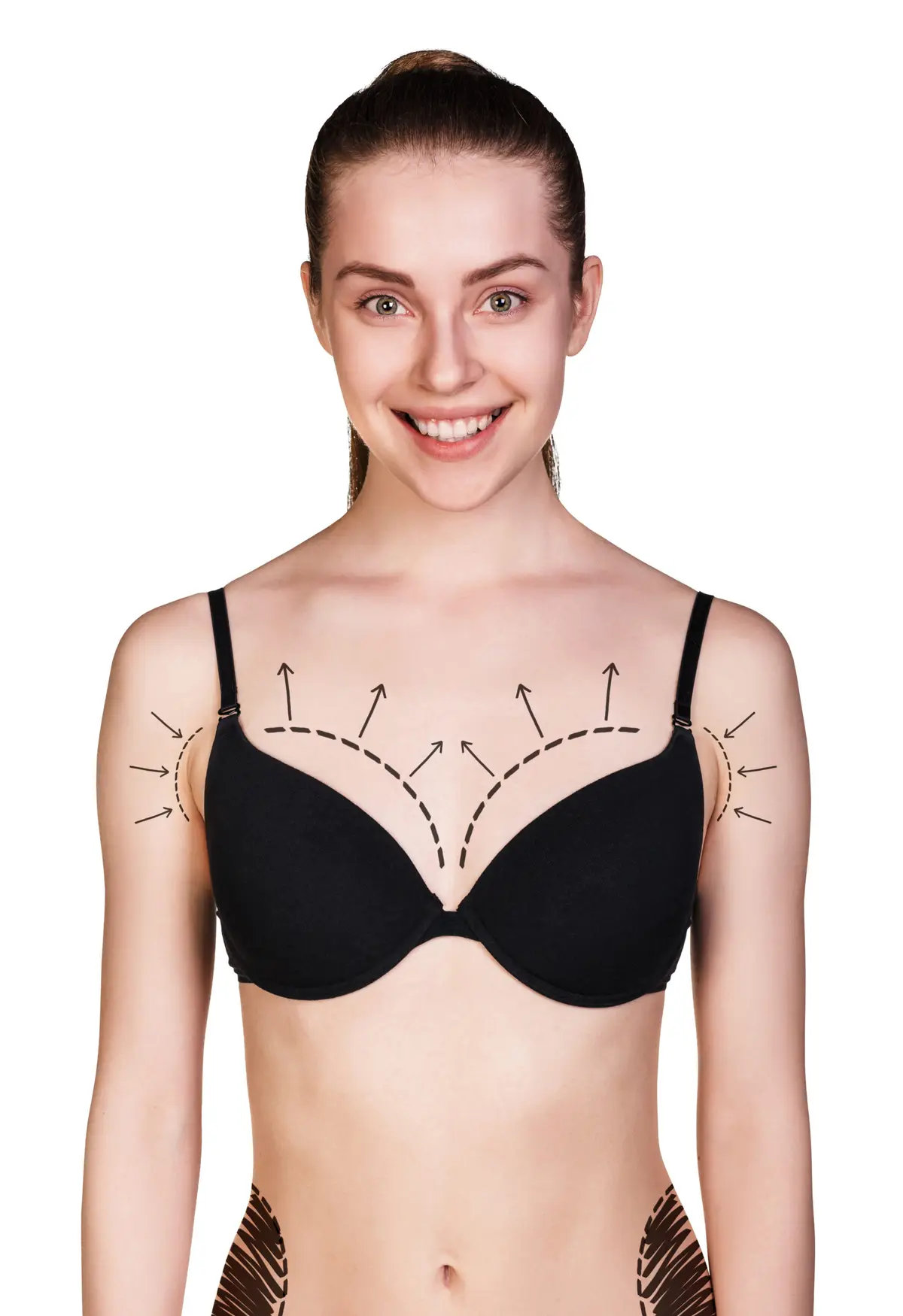 Can I Wear an Underwire Bra after Breast Augmentation? — Power Plastic Surgery, Toronto