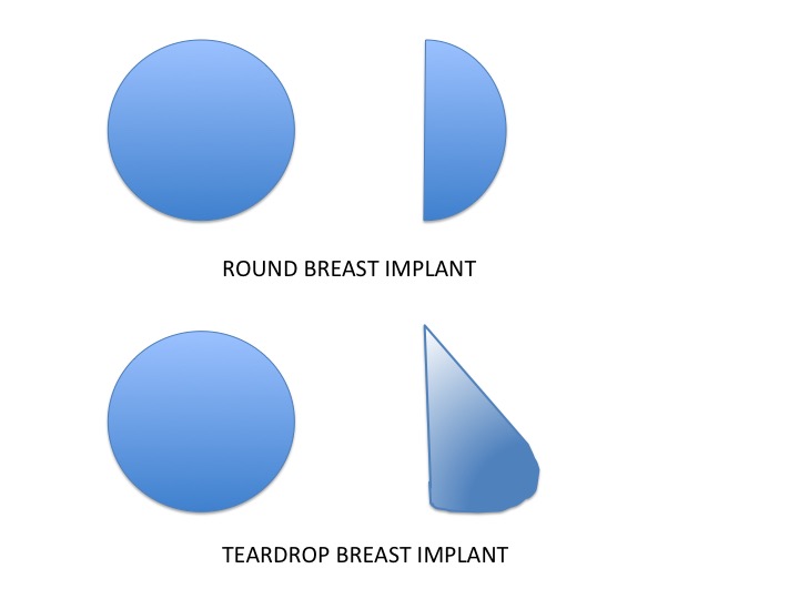 Options for breast implant shape - Power Plastic Surgery